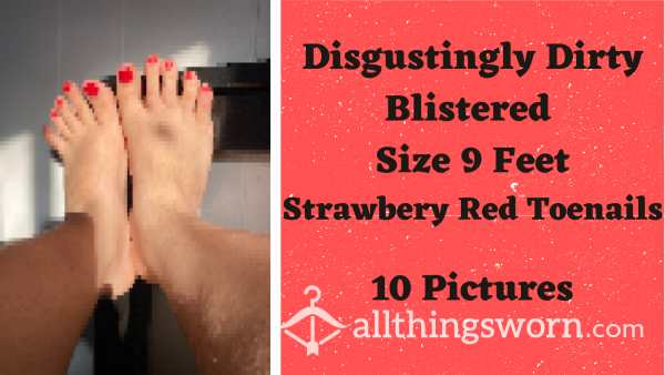 10 Pics | Dirty Disgusting Blistered Size 9 Feet | Strawberry Red Toenails | DIRTY FEET