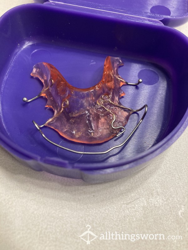 5+ Year Old USED Retainer!