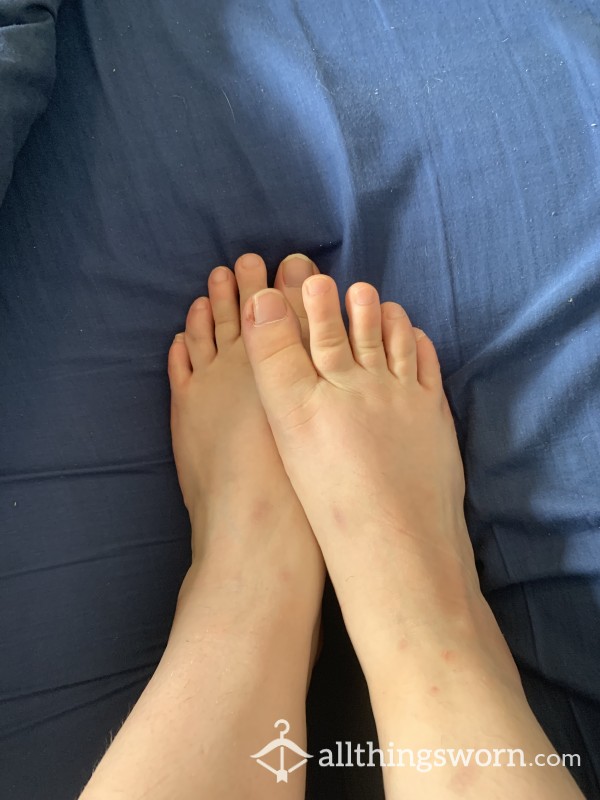 10 Pics Of My Feet After 2 Weeks CONTINUOUS WEAR