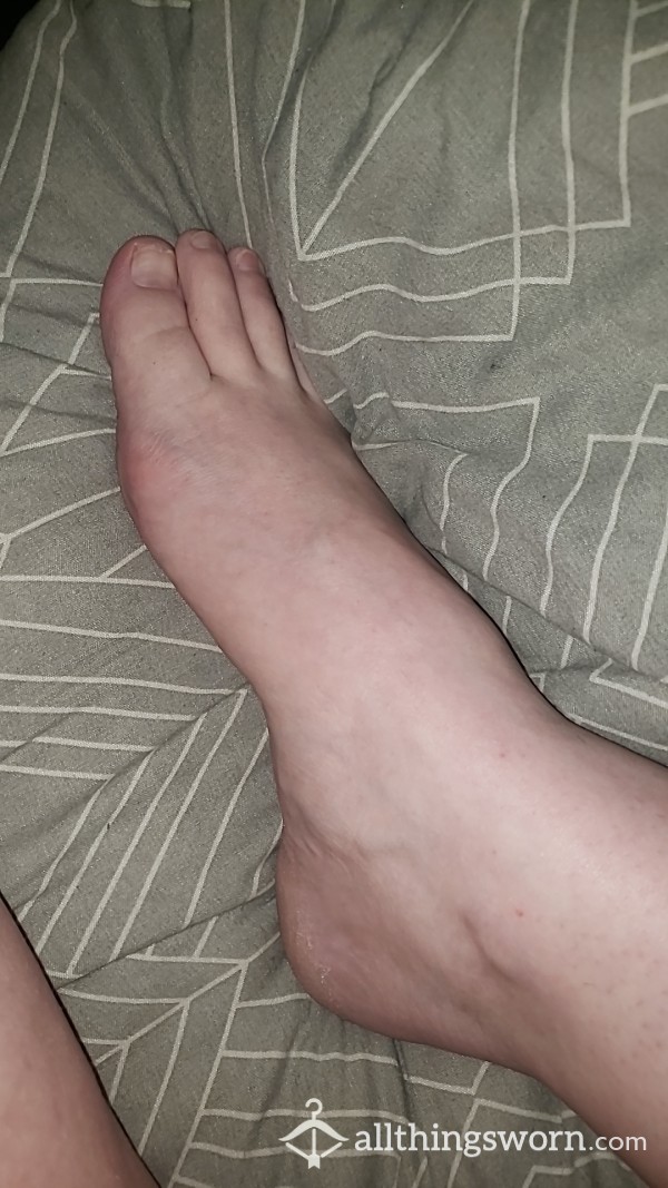 Bare Foot Rubbing Dry Skin Off