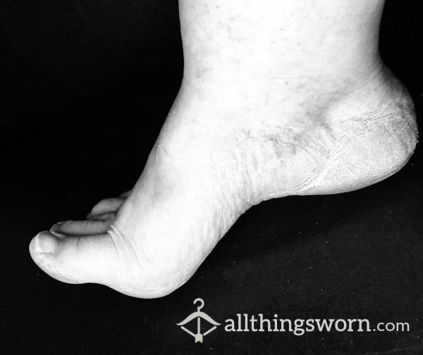 Black And White Foot Photos