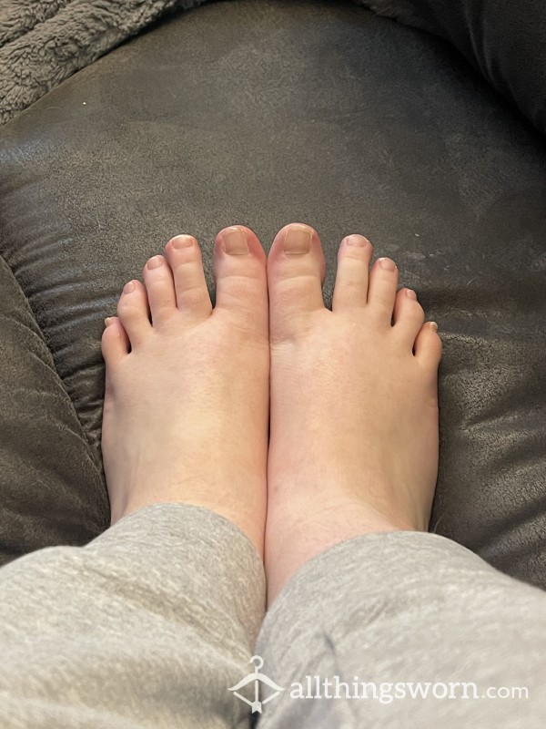Calloused Feet Pics With No Polish