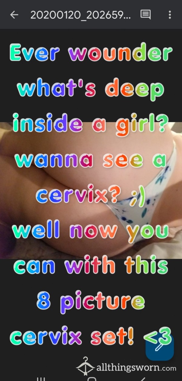 Cervix Photos
