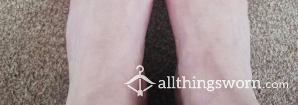 Dirty Feet Pics Includes Back Ankle Blister