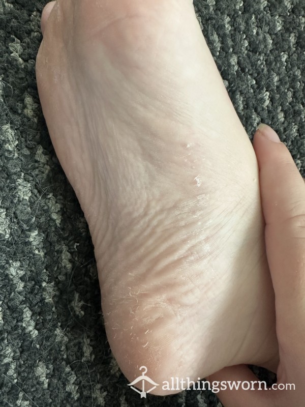 Feet Peeling