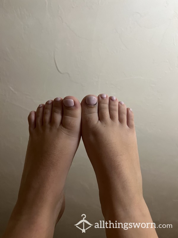 Feet Pics Before Pedicure (Scaly)