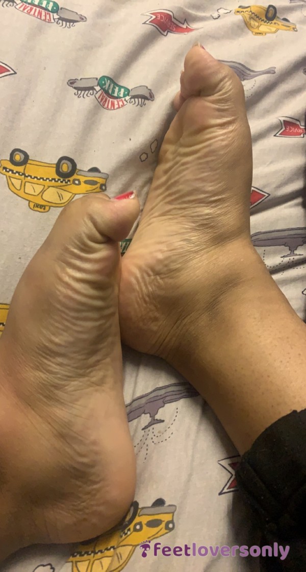 Feet Wrinkles