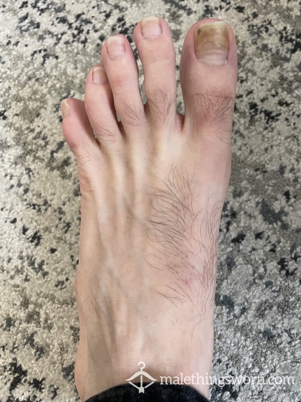 Foot Fetish