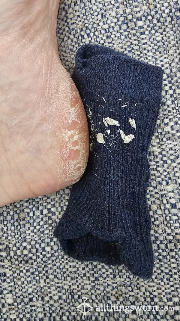 FOOT LOVERS Are Going To Lust After My CHUNKY Feet Shavings