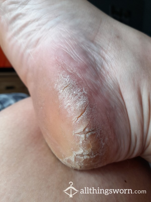 Foot Shaving Chunks (without Dust)