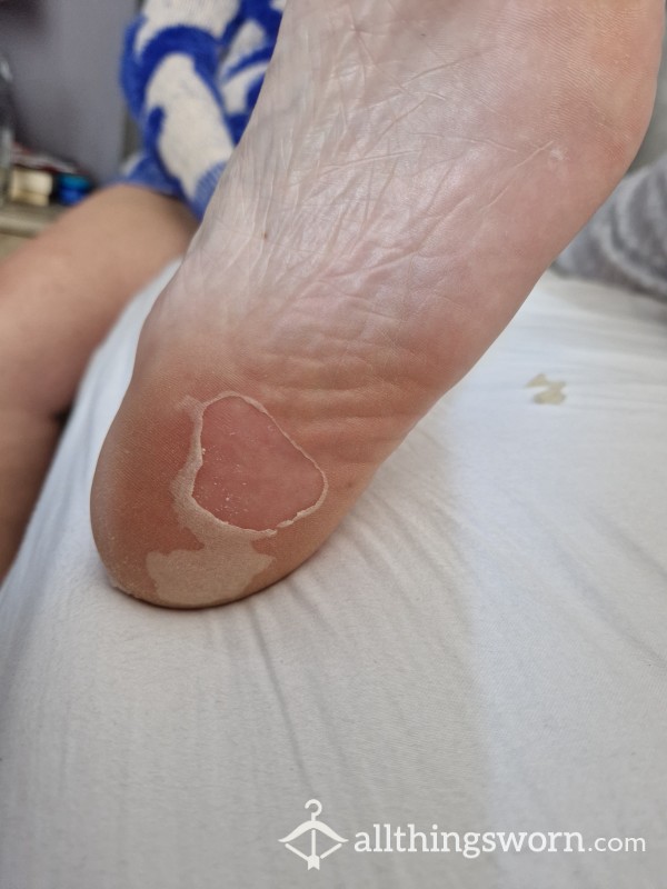Foot Skin From A Foot Mask