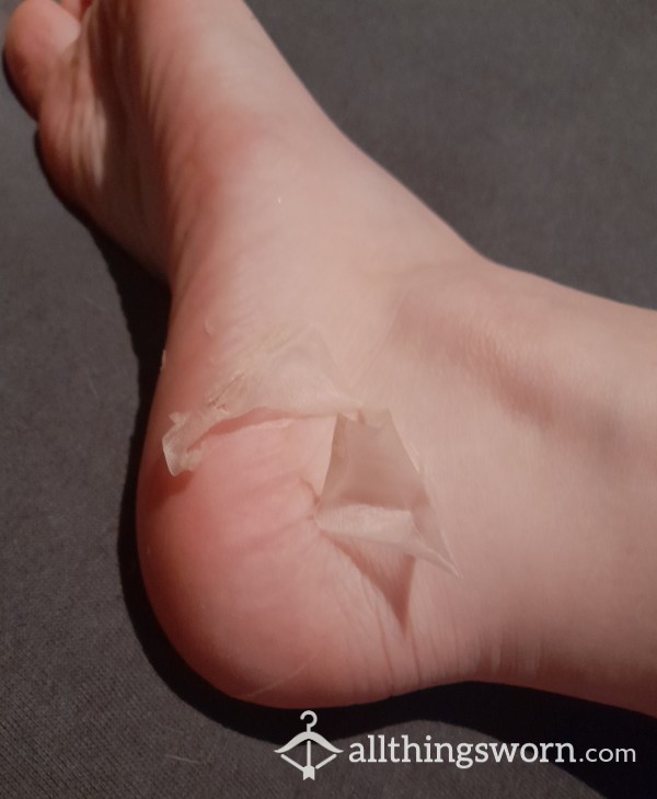 Foot Skin Peel Treatment