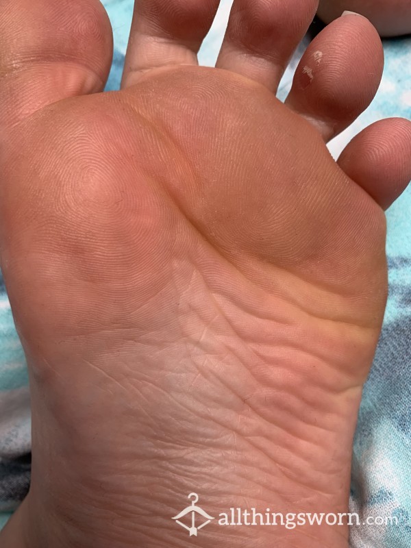 FOOT SOLE INVESTIGATION VIDEO
