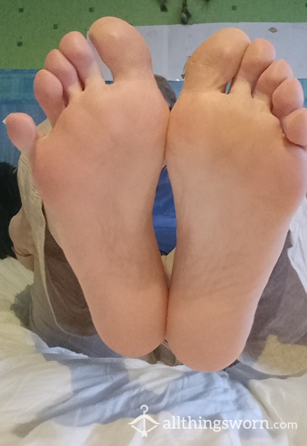 Horrible Calloused Feet With Yellowing Nails Ready For Playing!