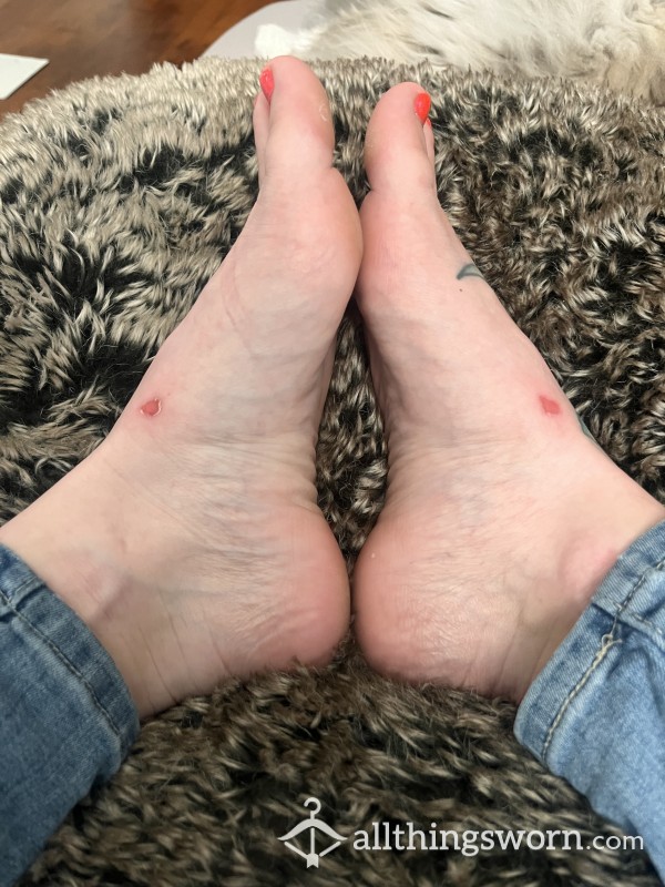 Hurt Feet’s