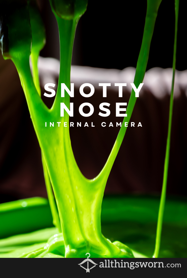Video :: Snotty Nose | 𝗜𝗻𝘁𝗲𝗿𝗻𝗮𝗹 𝗖𝗮𝗺𝗲𝗿𝗮