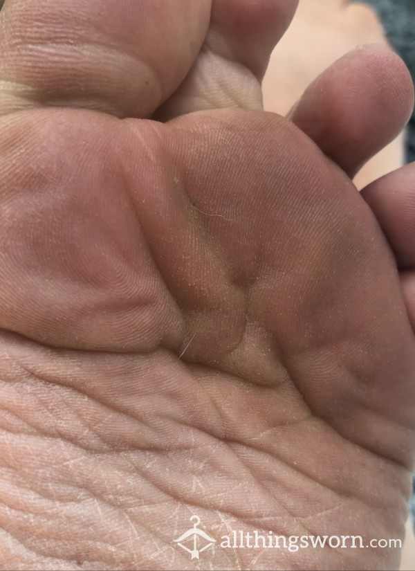 My Dirty, Dry Little Feet Showing Off For You! Wrinkly Wiggly Soles And Toes!