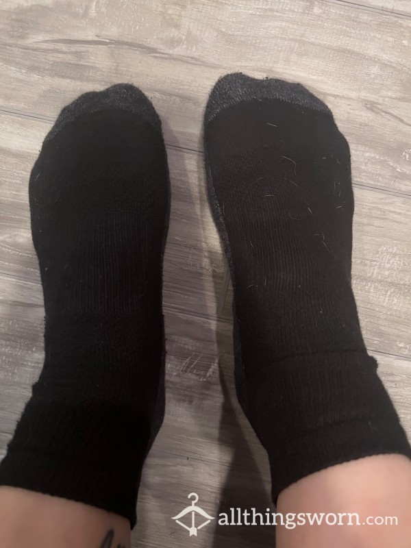 My Feet After A 12-hour Shift