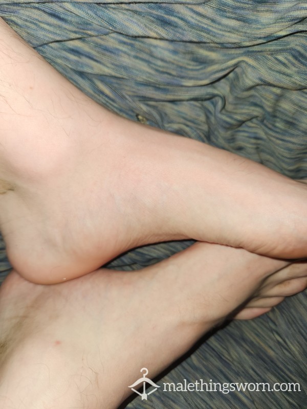 Nasty Toe Jammed Feet Pics