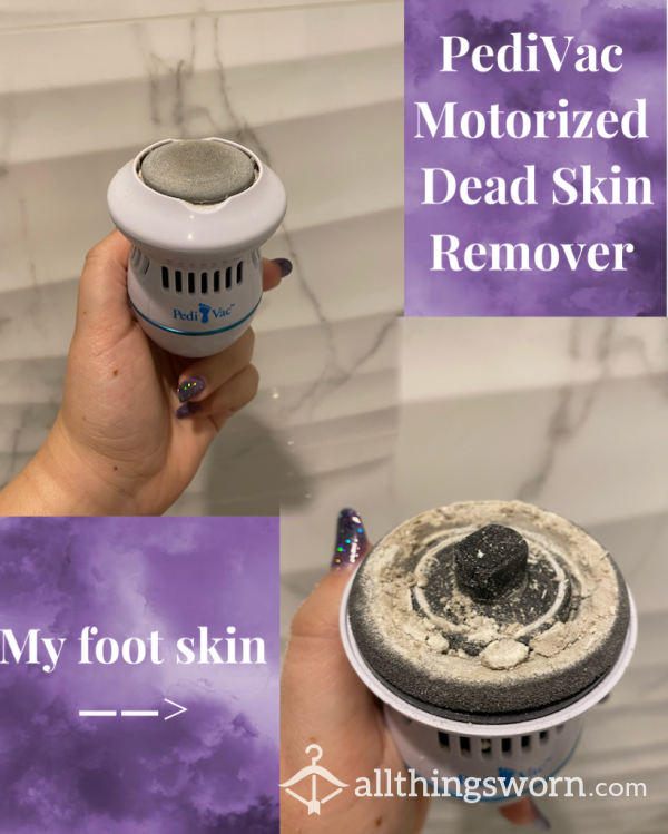 PediVac Electric Dead Skin Remover + All Of The Skin Inside Of It