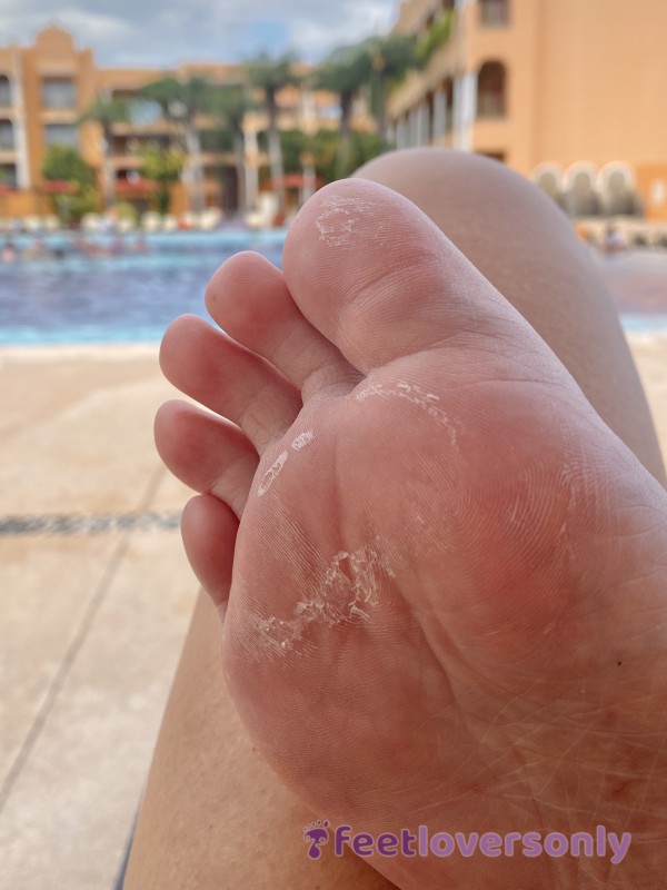 Peeling Soles By The Pool | Long Toes | High Arches