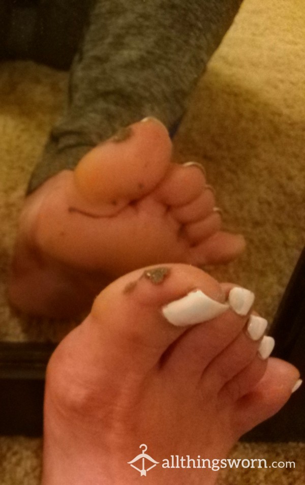 Pics Of Jammy Feet And Toes