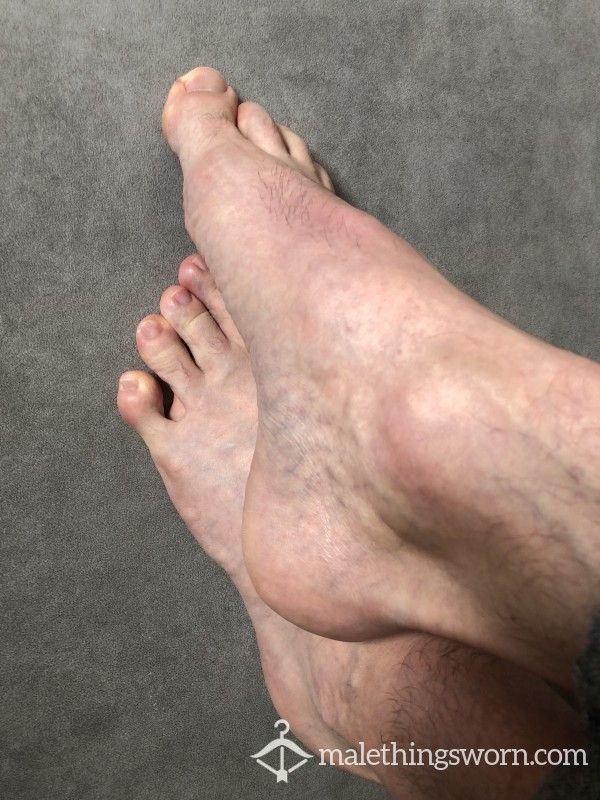 Picture Of My Feet