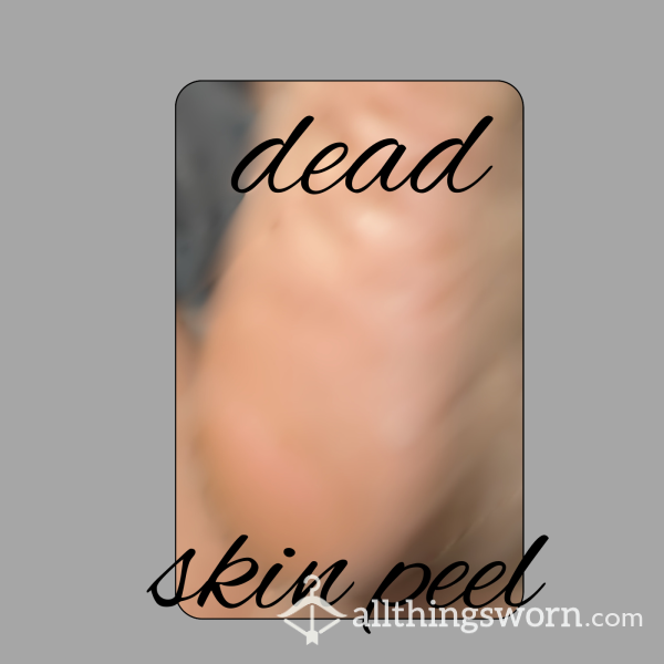 Soft Dead Skin