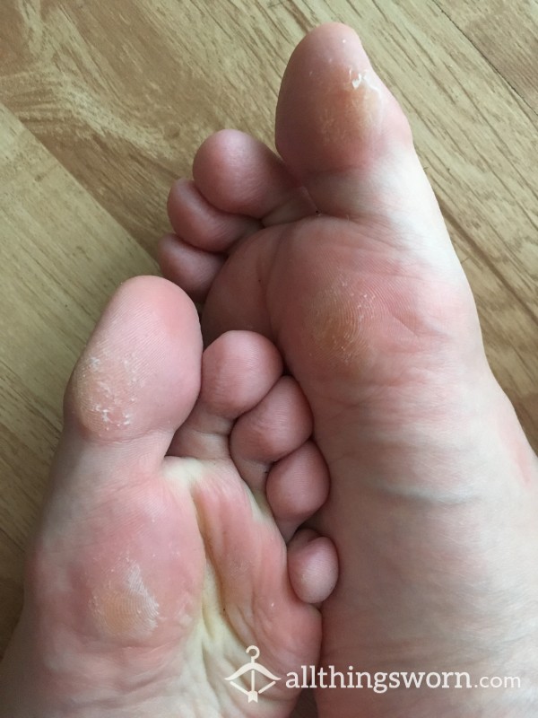 Swollen Feet After Long Flight