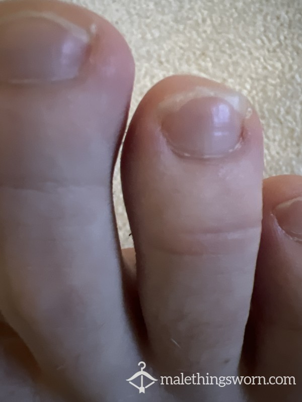 Toenail/fingernail Clippings