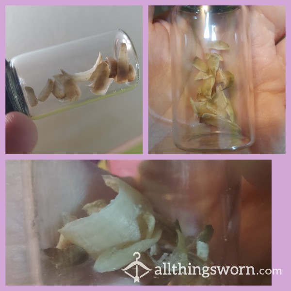 Vial Of Extra Long Gross Toe Nail Clippings [shipping Included]