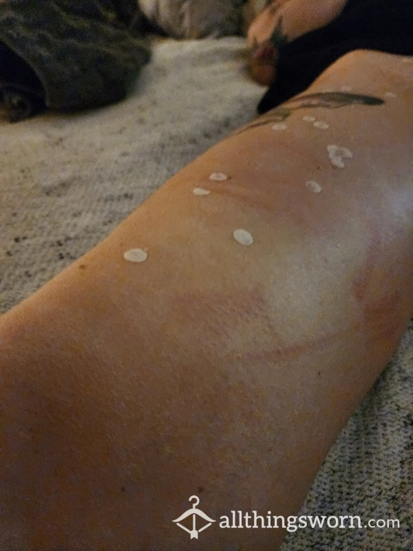 Wax Scraped Off My Skin With A Personal Photo