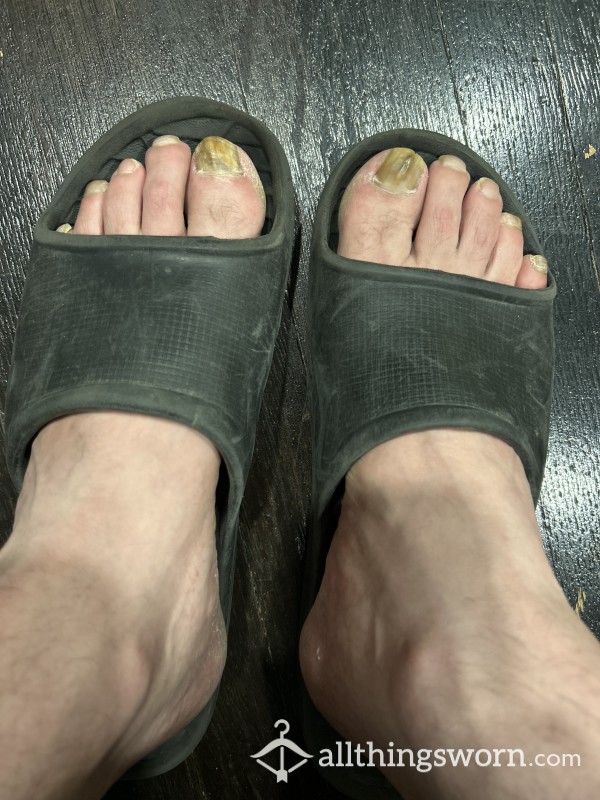 Worn Out Shower Shoes