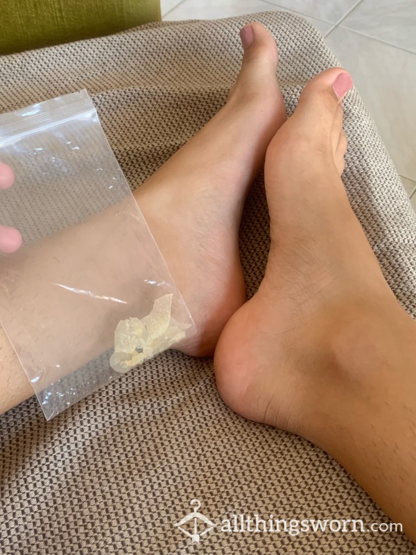 Your Favorite Foot Snacks | Feet Skin